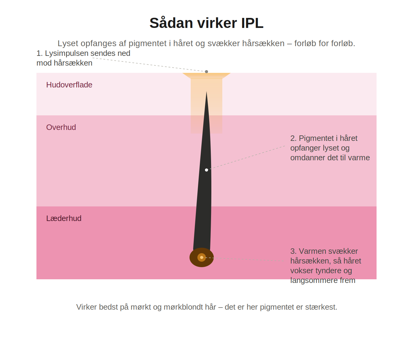 Aveline Lumi – IPL-hårborttagare för kropp och ansikte